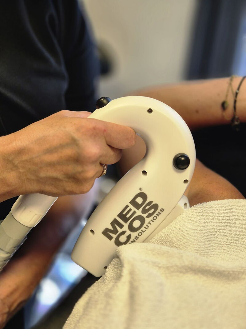 Close-up van de MedCos IPL-behandelkop in de hand van Caroline Voorhoeve