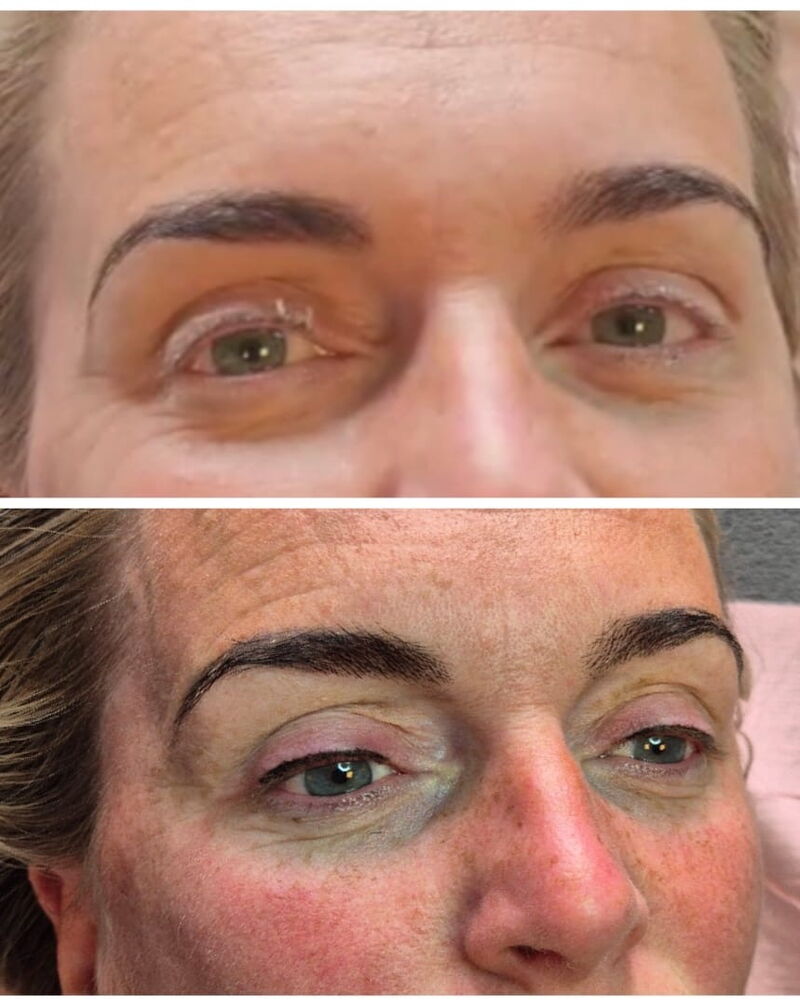 Voor en na permanente make-up: boven de ogen en wenkbrauwen vóór de behandeling, onder het resultaat met vollere, donkere wenkbrauwen